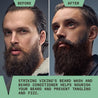 Striking Viking Beard Wash & Conditioner Set (Tea Tree & Biotin)
